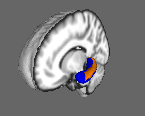 first3Dview.png