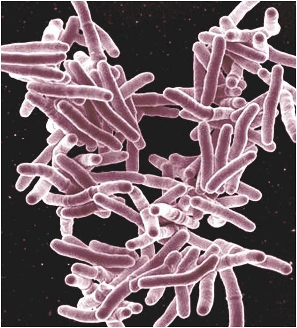 Spread of Infectious Disease